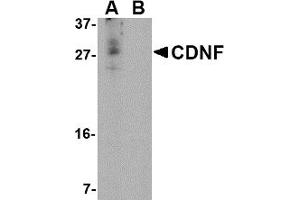 Image no. 1 for anti-Cerebral Dopamine Neurotrophic Factor (CDNF) (N-Term) antibody (ABIN203741) (CDNF 抗体  (N-Term))