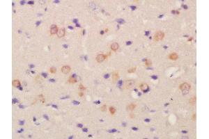 Formalin-fixed and paraffin embedded rat brain labeled with Rabbit Anti-FLRT2 Polyclonal Antibody, Unconjugated  at 1:200 followed by conjugation to the secondary antibody and DAB staining (FLRT2 抗体  (AA 201-300))
