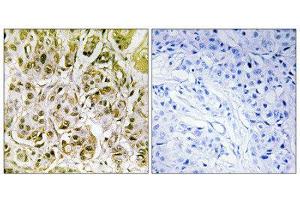 Immunohistochemistry (IHC) image for anti-SMAD, Mothers Against DPP Homolog 1 (SMAD1) (pSer187) antibody (ABIN1847369) (SMAD1 抗体  (pSer187))