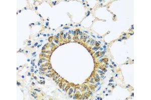 Immunohistochemistry of paraffin-embedded Mouse lung using DCP2 Polyclonal Antibody at dilution of 1:100 (40x lens). (DCP2 抗体)
