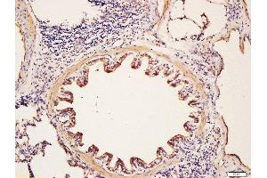 Formalin-fixed and paraffin embedded rat lung labeled with Rabbit Anti-Glycophorin C Polyclonal Antibody, Unconjugated (ABIN718991) at 1:200 followed by conjugation to the secondary antibody and DAB staining (CD236/GYPC 抗体  (AA 31-128))
