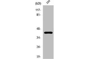 Western Blotting (WB) image for anti-Protein Kinase, CAMP-Dependent, Regulatory, Type I, alpha (Tissue Specific Extinguisher 1) (PRKAR1A) (C-Term) antibody (ABIN7185424)