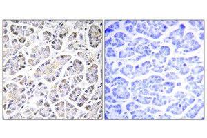 Immunohistochemistry (IHC) image for anti-ATP Synthase, H+ Transporting, Mitochondrial Fo Complex, Subunit C3 (Subunit 9) (ATP5G3) (N-Term) antibody (ABIN1850826) (ATP5G3 抗体  (N-Term))
