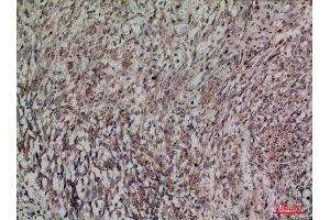 Immunohistochemistry (IHC) image for anti-Histidine Decarboxylase (HDC) (Internal Region) antibody (ABIN3187759)