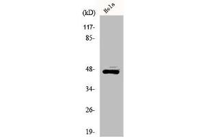 Western Blot analysis of HeLa cells using ILKAP Polyclonal Antibody (ILKAP 抗体  (Internal Region))