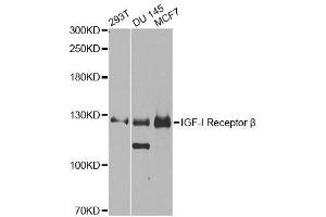 Western blot analysis of extracts of various cell lines, using IGF1R antibody (ABIN5970073) at 1/1000 dilution. (IGF1R 抗体  (N-Term))