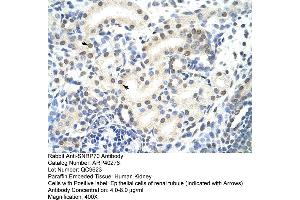 Rabbit Anti-SNRP70 Antibody  Paraffin Embedded Tissue: Human Kidney Cellular Data: Epithelial cells of renal tubule Antibody Concentration: 4. (SNRNP70 抗体  (N-Term))