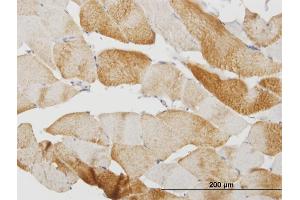 Immunoperoxidase of monoclonal antibody to CASQ2 on formalin-fixed paraffin-embedded human skeletal muscle. (CASQ2 抗体  (AA 20-399))