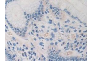 Immunohistochemistry (IHC) image for anti-Pyruvate Dehydrogenase Complex, Component X (PDHX) (AA 220-468) antibody (ABIN7443305)