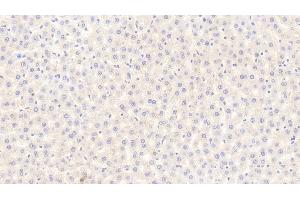 Detection of FGF21 in Rat Liver Tissue using Polyclonal Antibody to Fibroblast Growth Factor 21 (FGF21) (FGF21 抗体  (AA 25-208))