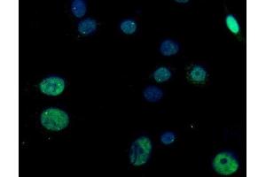 IF analysis of RGS12 using anti-RGS12 antibody (ABIN7602410).