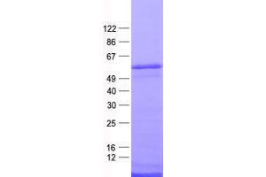 Western Blotting (WB) image for Zinc Finger Protein 365 (ZNF365) protein (His tag) (ABIN2736027)
