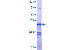 Image no. 1 for Sarcoma Antigen 1 (SAGE1) (AA 357-455) protein (GST tag) (ABIN1319119)