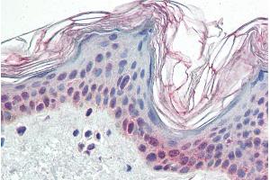 ABIN185561 (5µg/ml) staining of paraffin embedded Human Skin. (PARP2 抗体  (Internal Region))