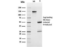 SDS-PAGE Analysis Purified MerTK Mouse Monoclonal Antibody (MERTK/3022). (MERTK 抗体  (AA 55-148))