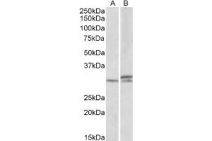 Western Blot (1μg/ml) staining of Mouse and Rat Spinal Cord lysates (35μg protein in RIPA buffer).