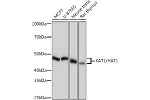 Western blot analysis of extracts of various cell lines, using K/H Rabbit mAb (ABIN7267702) at 1:1000 dilution. (HAT1 抗体)