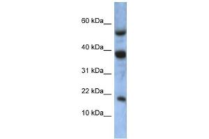 WB Suggested Anti-ATXN7L1 Antibody Titration: 0. (ATXN7L1 抗体  (Middle Region))