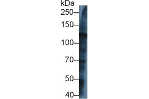 Western blot analysis of Human U2OS cell lysate, using Rat KIF5A Antibody (1 µg/ml) and HRP-conjugated Goat Anti-Rabbit antibody ( (KIF5A 抗体  (AA 823-1027))