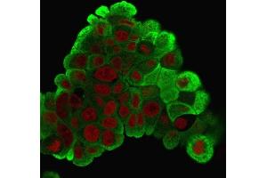 Immunofluorescence (IF) image for anti-Heat Shock 27kDa Protein 1 (HSPB1) antibody (ABIN6939661)