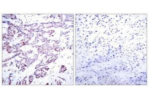 Immunohistochemistry (IHC) image for anti-Signal Transducer and Activator of Transcription 6, Interleukin-4 Induced (STAT6) (pThr645) antibody (ABIN7138872)