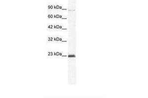 Image no. 1 for anti-Minichromosome Maintenance Deficient 4 (MCM4) (C-Term) antibody (ABIN203262) (MCM4 抗体  (C-Term))