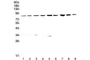 Western blot testing of human 1) HeLa, 2) 293T, 3) MCF7, 4) COLO320, 5) 22RV1 6) SK-OV-3, 7) rat stomach, 8) rat liver and 9) mouse liver lysate wtih CD2AP antibody at 0.