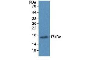 Detection of Recombinant ALOX15, Human using Monoclonal Antibody to Arachidonate-15-Lipoxygenase (ALOX15) (ALOX15 抗体  (AA 170-312))