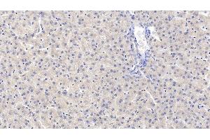 Immunohistochemistry (IHC) image for anti-Microtubule-Associated Protein, RP/EB Family, Member 1 (MAPRE1) (AA 2-268) antibody (ABIN7427183)