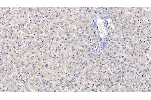 Detection of MAPRE1 in Human Liver Tissue using Monoclonal Antibody to Microtubule Associated Protein RP/EB Family, Member 1 (MAPRE1) (MAPRE1 抗体  (AA 2-268))