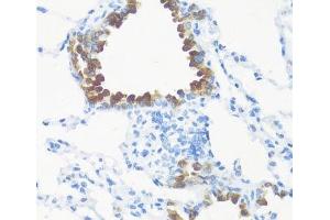 Immunohistochemistry of paraffin-embedded Mouse lung using FGF10 Polyclonal Antibody at dilution of 1:100 (40x lens). (FGF10 抗体)