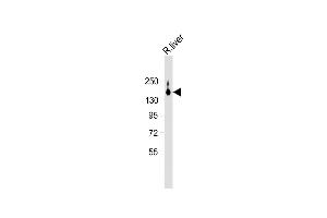 Anti-ATP7B Antibody (C-term) at 1:2000 dilution + Rat liver lysate Lysates/proteins at 20 μg per lane.