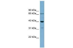 H2AFY2 antibody used at 1 ug/ml to detect target protein. (H2AFY2 抗体  (Middle Region))
