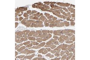 Immunohistochemical staining of human heart muscle with CCDC80 polyclonal antibody  shows moderate cytoplasmic positivity in myocytes at 1:50-1:200 dilution. (CCDC80 抗体)