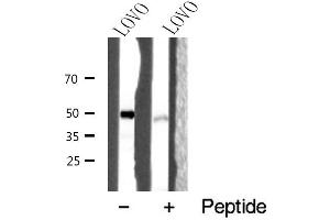 anti-Pyroglutamylated RFamide Peptide Receptor (QRFPR) (Internal Region) antibody