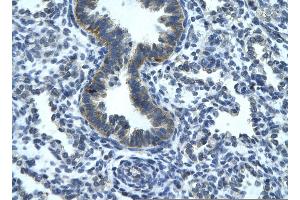 Rabbit Anti-RGS19 Antibody       Paraffin Embedded Tissue:  Human bronchiole epithelium   Cellular Data:  Epithelial cells of renal tubule  Antibody Concentration:   4. (RGS19 抗体  (N-Term))