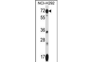SLC41A2 Antibody (N-term) (ABIN657753 and ABIN2846735) western blot analysis in NCI- cell line lysates (35 μg/lane). (SLC41A2 抗体  (N-Term))