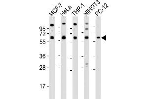 All lanes : Anti-PKM2 antibody at 1:2000 dilution Lane 1: MCF-7 whole cell lysates Lane 2: Hela whole cell lysates Lane 3: THP-1 whole cell lysates Lane 4: NIH/3T3 whole cell lysates Lane 5: PC-12 whole cell lysates Lysates/proteins at 20 μg per lane. (PKM2 抗体  (N-Term))