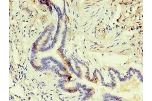 Immunohistochemistry of paraffin-embedded human lung using ABIN7140933 in 30 μg/mL dilute concentrations. (CD14 抗体)
