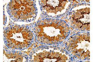 ABIN6265691 and ABIN6276606 at 1/100 staining Mouse testis tissue by IHC-P.