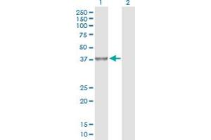 Western Blotting (WB) image for anti-Protein Phosphatase 2A Activator, Regulatory Subunit 4 (PPP2R4) (AA 1-323) antibody (ABIN519124)