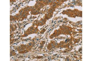 Immunohistochemistry (IHC) image for anti-Cytochrome P450, Family 39, Subfamily A, Polypeptide 1 (CYP39A1) antibody (ABIN2423239)