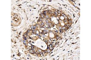 IHC analysis of IRBIT/AHCYL1 using anti-IRBIT/AHCYL1 antibody (ABIN7600030). (AHCYL1 抗体  (AA 14-57))
