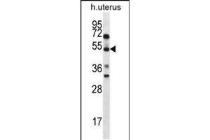 Western blot analysis in human normal Uterus tissue lysates (35ug/lane). (ABRA 抗体  (C-Term))