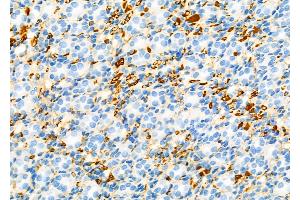 ABIN6257051 and ABIN6274616 at 1/100 staining Rat kidney tissue by IHC-P. (CDCA3 抗体  (C-Term))