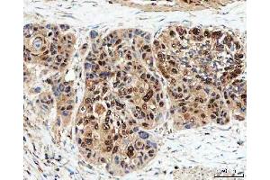 IHC analysis of SDE2 using anti-SDE2 antibody (ABIN7599603). (C1orf55 抗体  (AA 10-447))