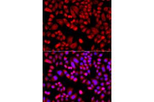Immunofluorescence analysis of A549 cells using ARPC3 antibody. (ARPC3 抗体)