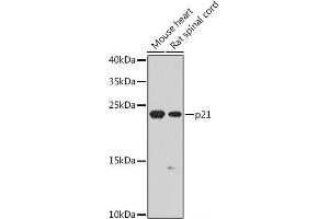 Western blot analysis of extracts of various cell lines using p21 Polyclonal Antibody at dilution of 1:1000. (p21 抗体)