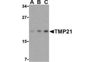 Western blot analysis of TMP21 in mouse brain tissue lysate with this product at (A) 0. (TMED10 抗体  (Center))
