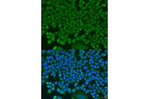 Immunofluorescence analysis of U2OS cells using HS1BP3 antibody. (HS1BP3 抗体  (AA 1-200))